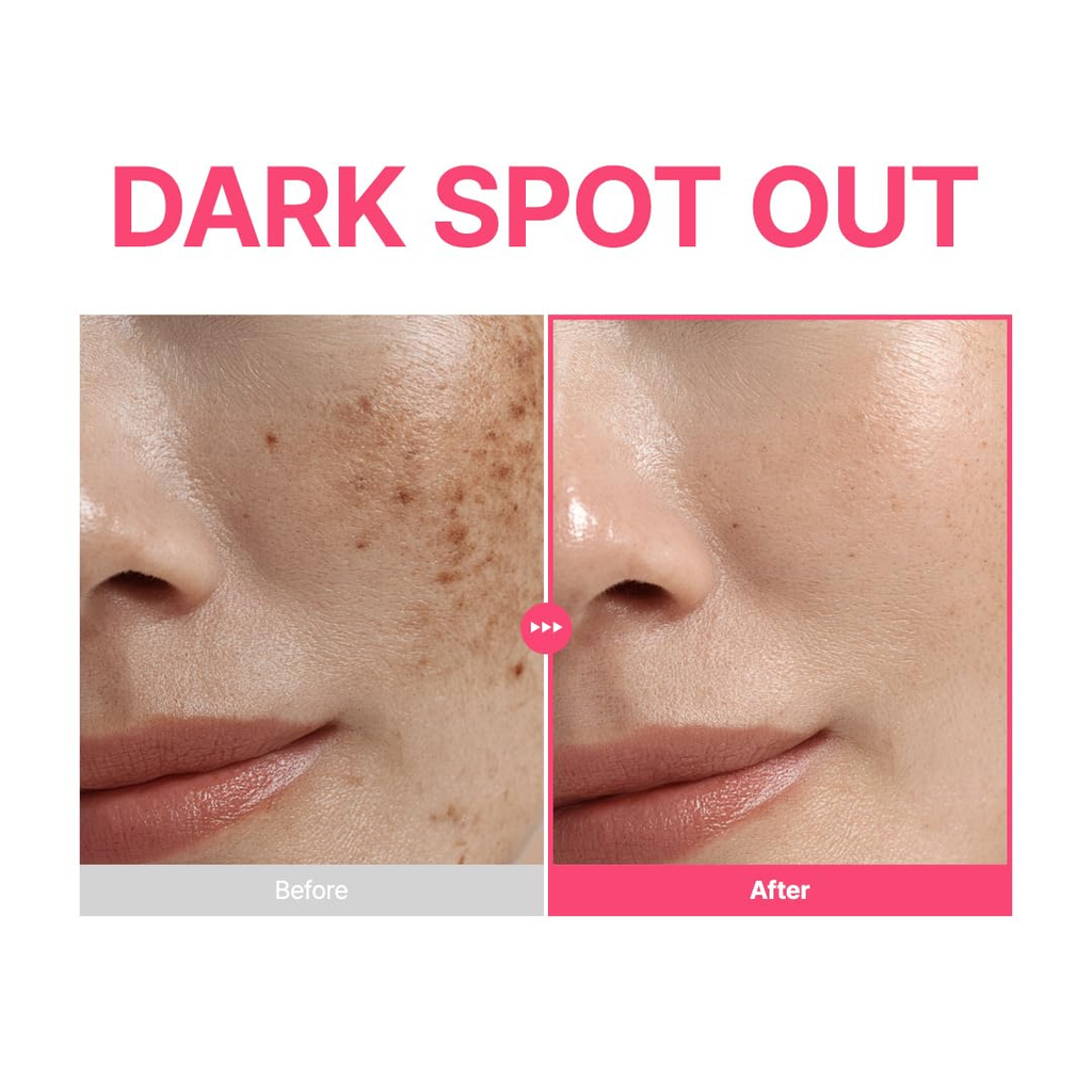 PURITO TXA 6% + Niacinamide 10% Facial Serum | for Dark Spots, Hyperpigmentation, Uneven Skin Tone | High-Concentration Tranexamic Acid | Korean Skincare, 30mL Purito Seoul