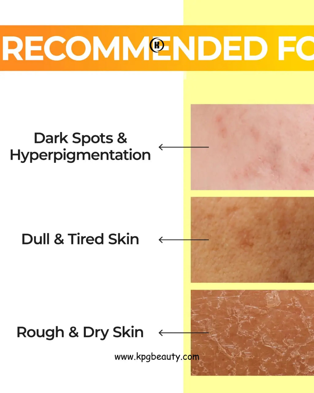 numbuzin No.5 Toner | Vitamin Boosting Essential Toner | First Step Skin Care | Improves Hyperpigmentation and Uneven Skin Tone | 6.76 fl. oz. Numbuzin