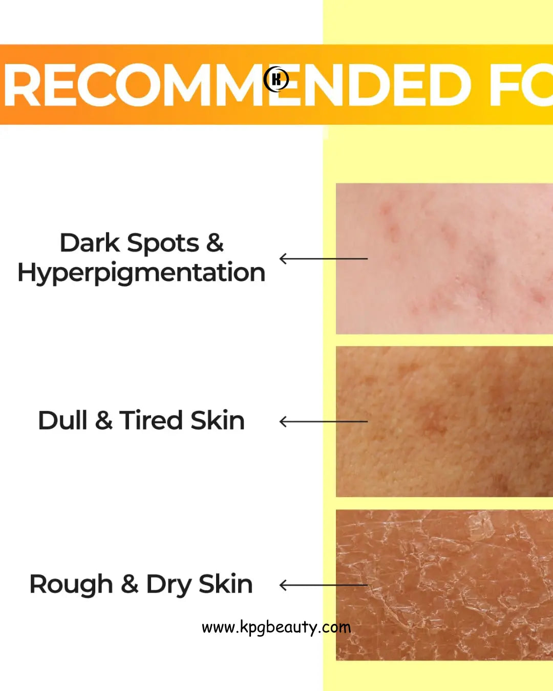 numbuzin No.5 Toner | Vitamin Boosting Essential Toner | First Step Skin Care | Improves Hyperpigmentation and Uneven Skin Tone | 6.76 fl. oz. Numbuzin