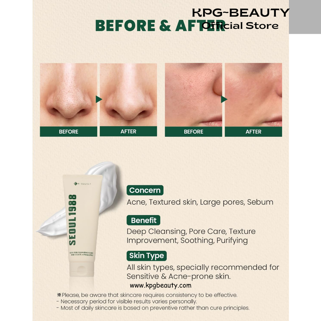 K-SECRET SEOUL 1988 Cica Cleansing Foam – Deep Pore Cleansing & Soothing Care | Daily Facial Cleanser for Sensitive Skin | Korean Skincare, 150ml KSecret