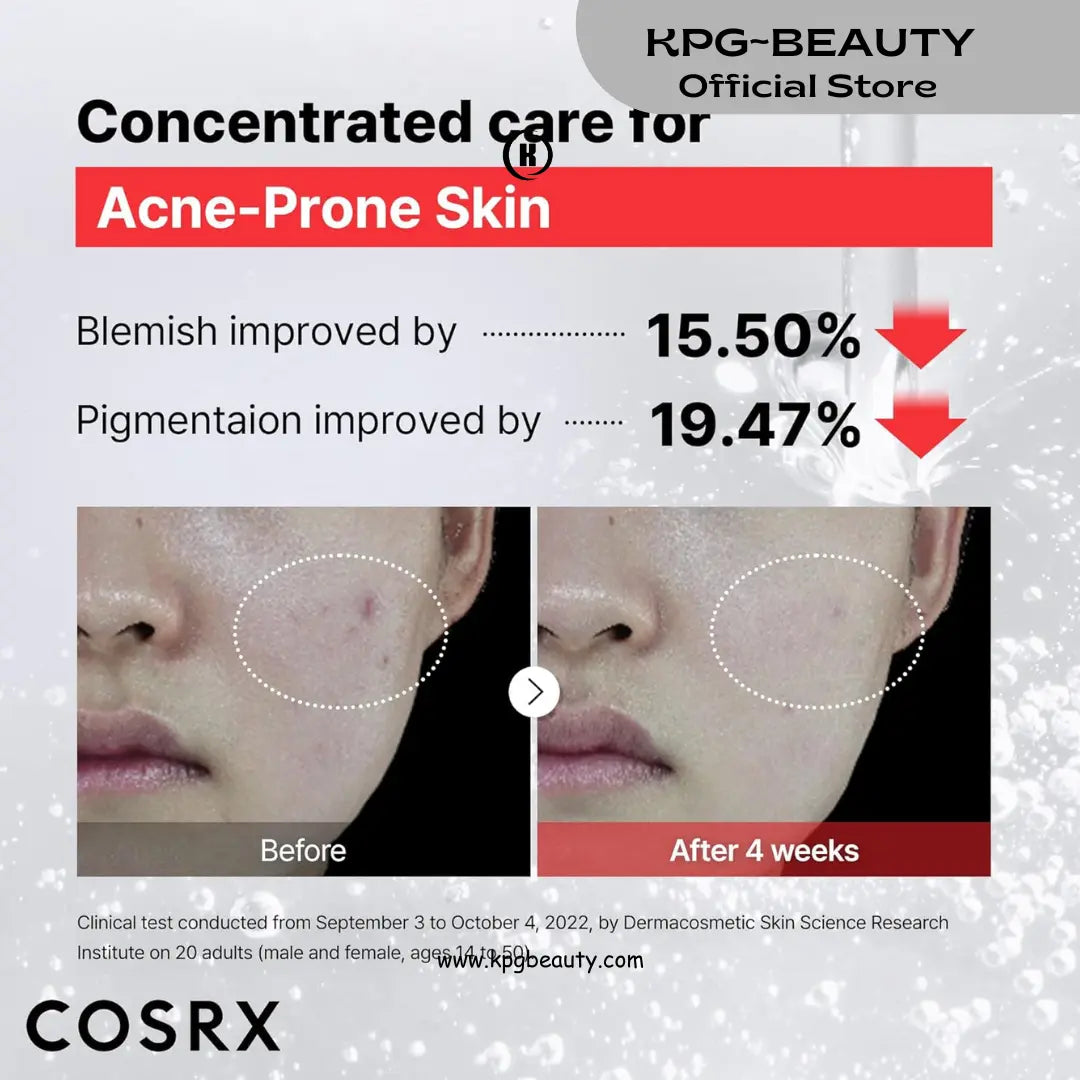COSRX 15% Niacinamide Face Serum, 0.67 fl oz, Pore Minimizer Serum for Face, Even Skin Tone, Korean Skin Care KPG BEAUTY COSRX