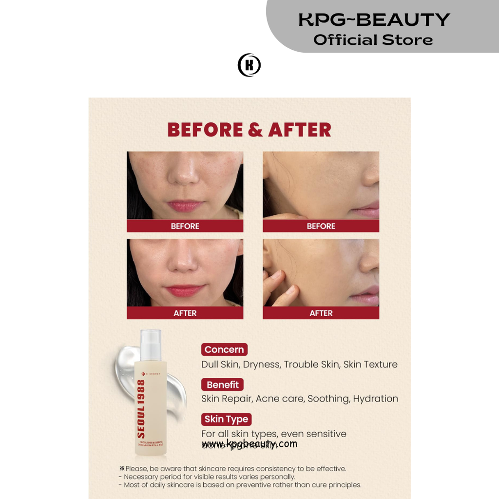 K-SECRET SEOUL 1988 Snail Mucin 97% Essence – Concentrated Yet Lightweight Formula Infused with 97% Snail Mucin | Soothing & Fast-Absorption Facial Serum | Korean Skincare, 100ml KSecret