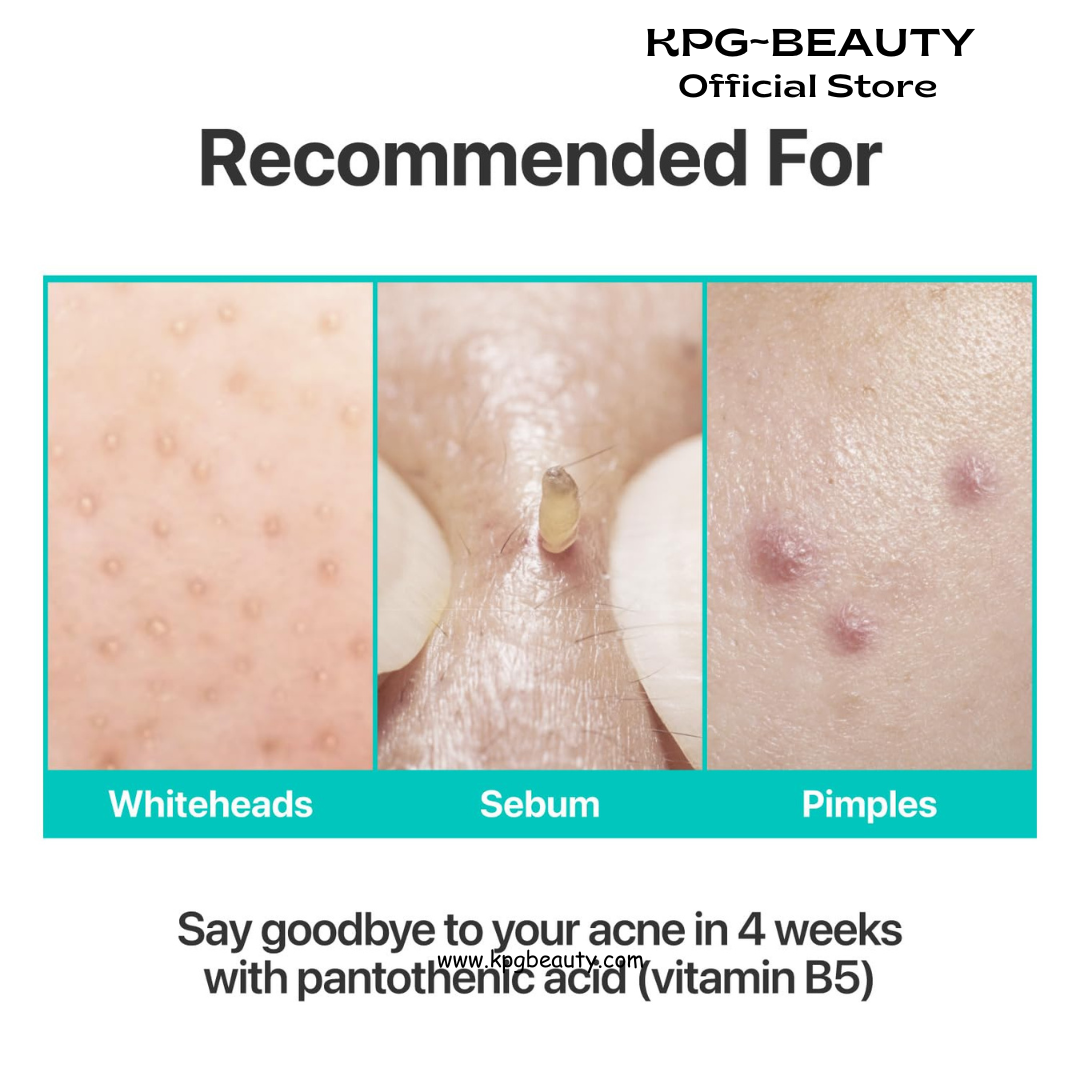 numbuzin No.1 Pantothenic B5 Active Soothing Cream | Remove sebum and skin troubles, Pantothenic acid, Korean Skincare Gift for Women | 2.70 fl oz Numbuzin