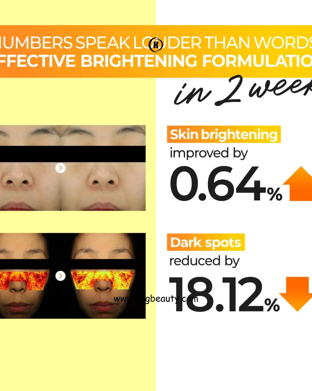 numbuzin No.5 Toner | Vitamin Boosting Essential Toner | First Step Skin Care | Improves Hyperpigmentation and Uneven Skin Tone | 6.76 fl. oz. Numbuzin