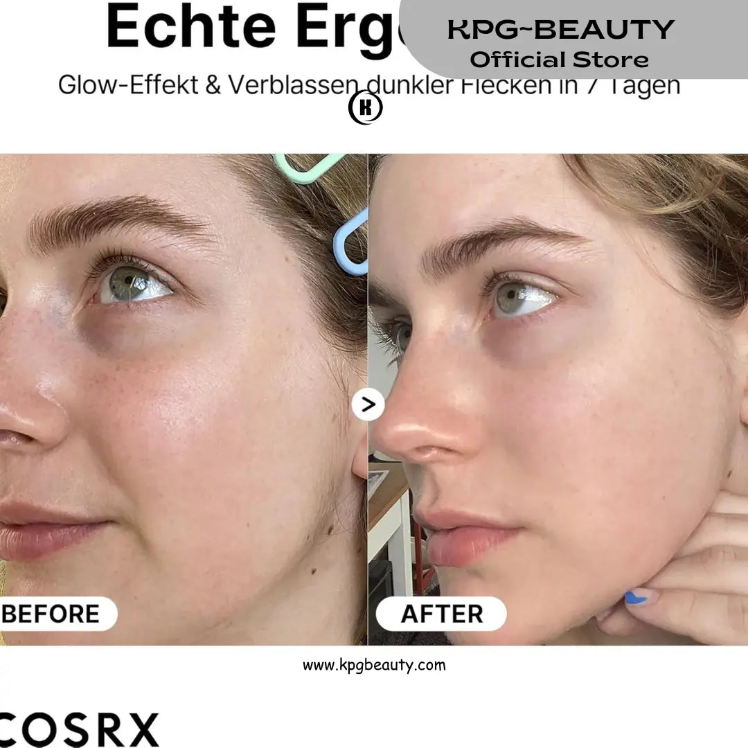 COSRX Pure Vitamin C 23% Serum with Vitamin E & Hyaluronic Acid, Hydrating Facial Serum for Fine Lines, Uneven Skin Tone & Dull Skin, 0.7oz/20g, Korean Skin Care KPG BEAUTY COSRX