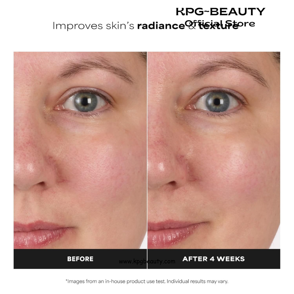 Paula's Choice SKIN BALANCING Pore-Reducing Face Toner with Niacinamide, for Oily Skin & Combination, Minimizes Large Pores, Controls Oil & Shine, Hydrates & Replenishes, Fragrance-Free 190ml Paula’s Choice
