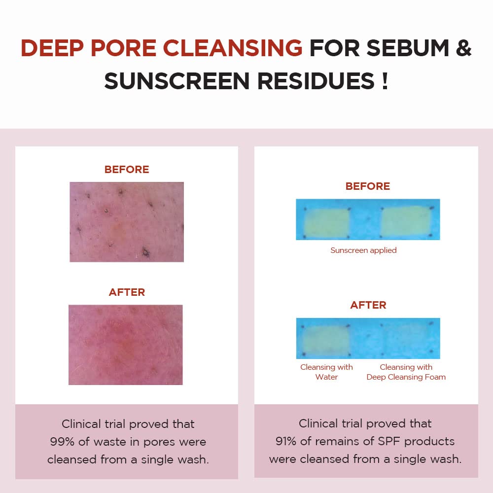 Skin1004 Poremizing Deep Cleansing Foam Sebum-removing Deep Cleanser 125 ml