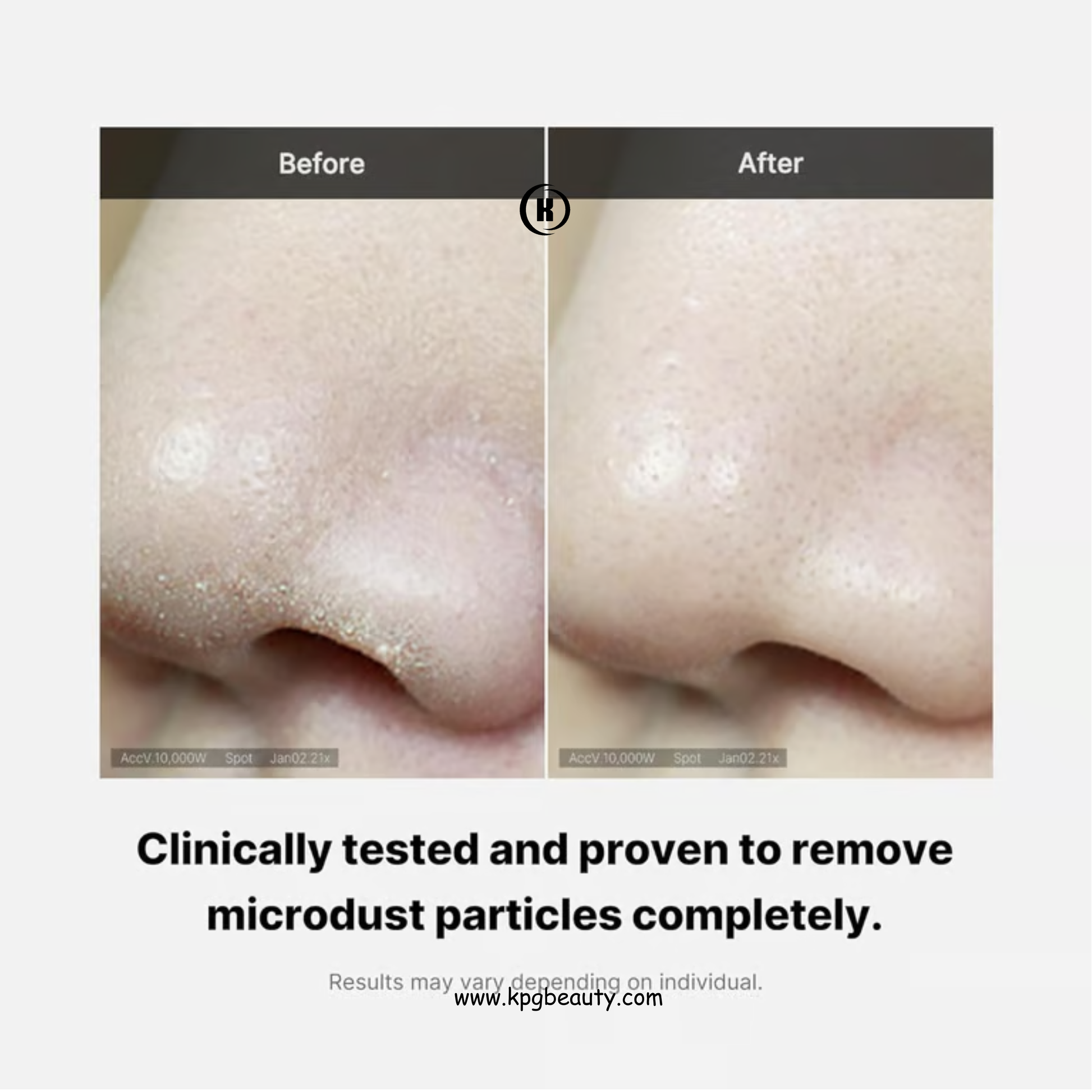Medicube Zero Foam Cleanser for Sensitive Skin - Sebum Control, Moisture Balance, and Pore Minimization | Korean Skincare