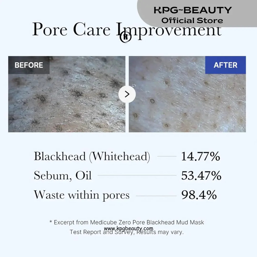 Medicube Zero Pore Blackhead Mud Mask – Pore Tightening & Skin Cooling Clay Mask | K-Beauty Nepal - KPGBEAUTY