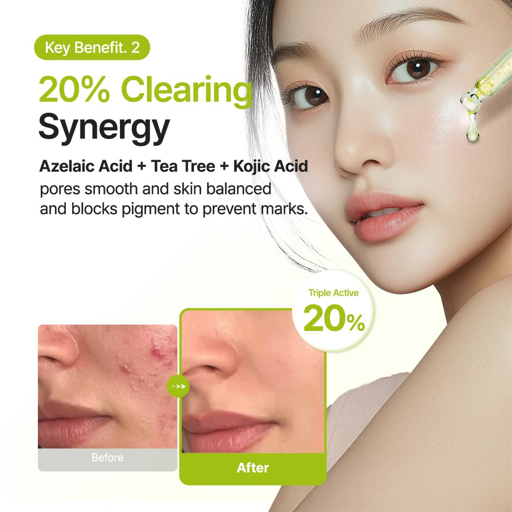PURITO Azelaic Acid 10% + Kojic Acid + Tea Tree Facial Serum | for Blemish-Prone, Oily & Sensitive Skin | Redness Soothing | Korean Skincare, 30mL Purito Seoul