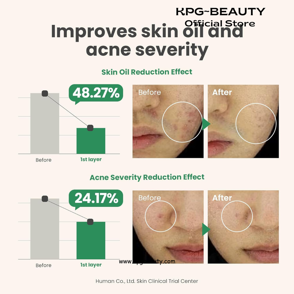 AXIS-Y Spot The Difference Blemish Spot Treatment - 4-Terpineol 2% Niacinamide AHA BHA Soothes Breakouts & Skin Barrier Repair - Vegan Korean Skin Care Face Serum (0.50 fl. oz.) AXIS-Y