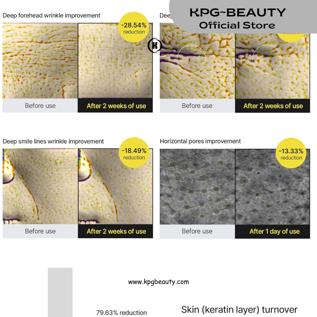 Celimax Vita A Retinal Shot Tightening Booster 15ml | 0.1% Retinal Serum KPG BEAUTY Celimax