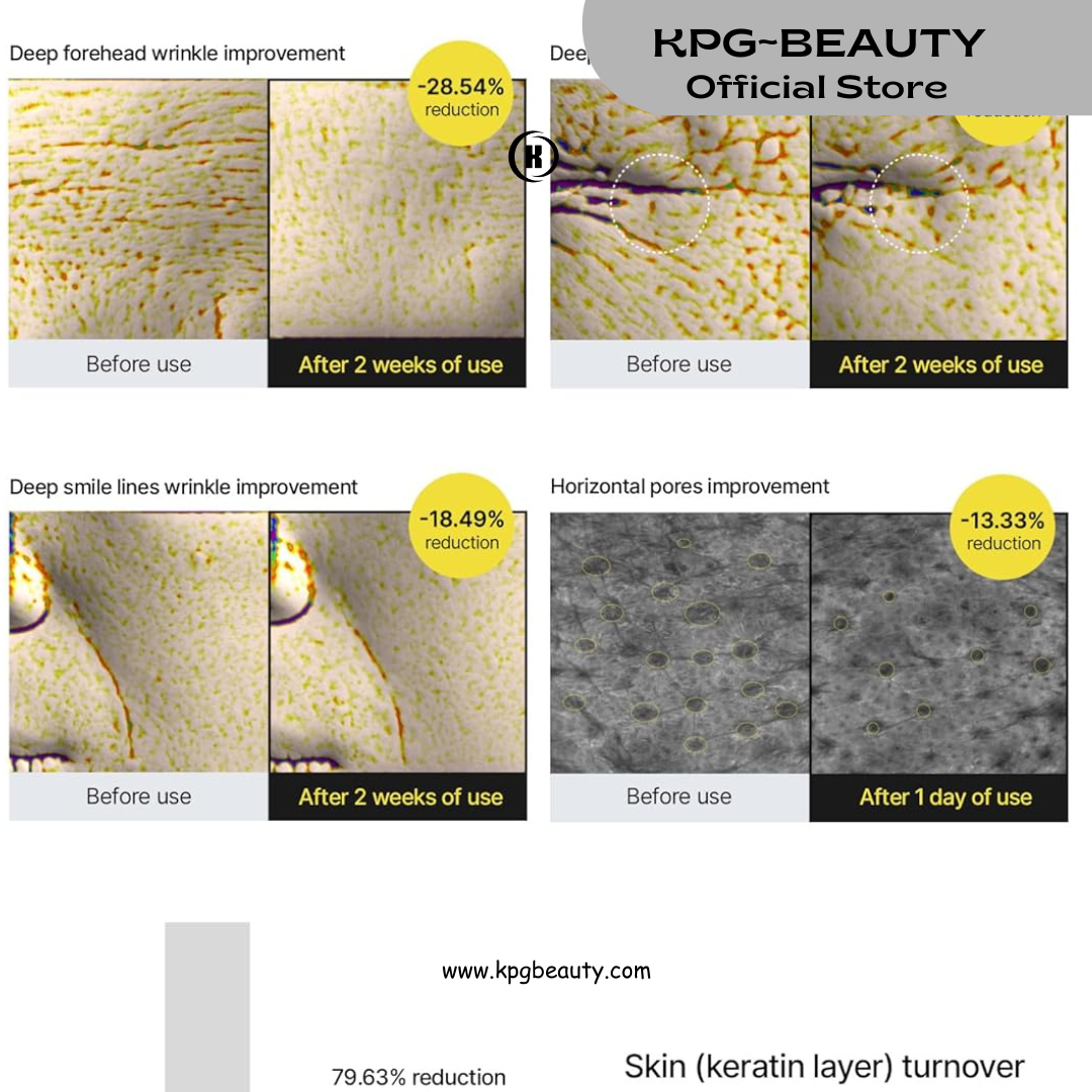 Celimax Vita A Retinal Shot Tightening Booster 15ml | 0.1% Retinal Serum KPG BEAUTY Celimax