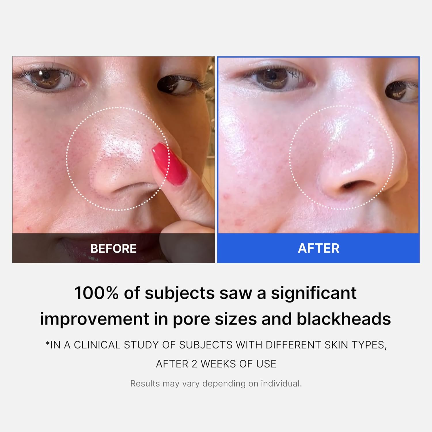 Medicube Zero Pore Pads 2.0, Dual-Textured Facial Toner Pads for Exfoliation and Pore Care with 4.5% AHA Lactic Acid & 0.45% BHA Salicylic Acid, Ideal for All Skin Types, Korean Skin Care (70 units)