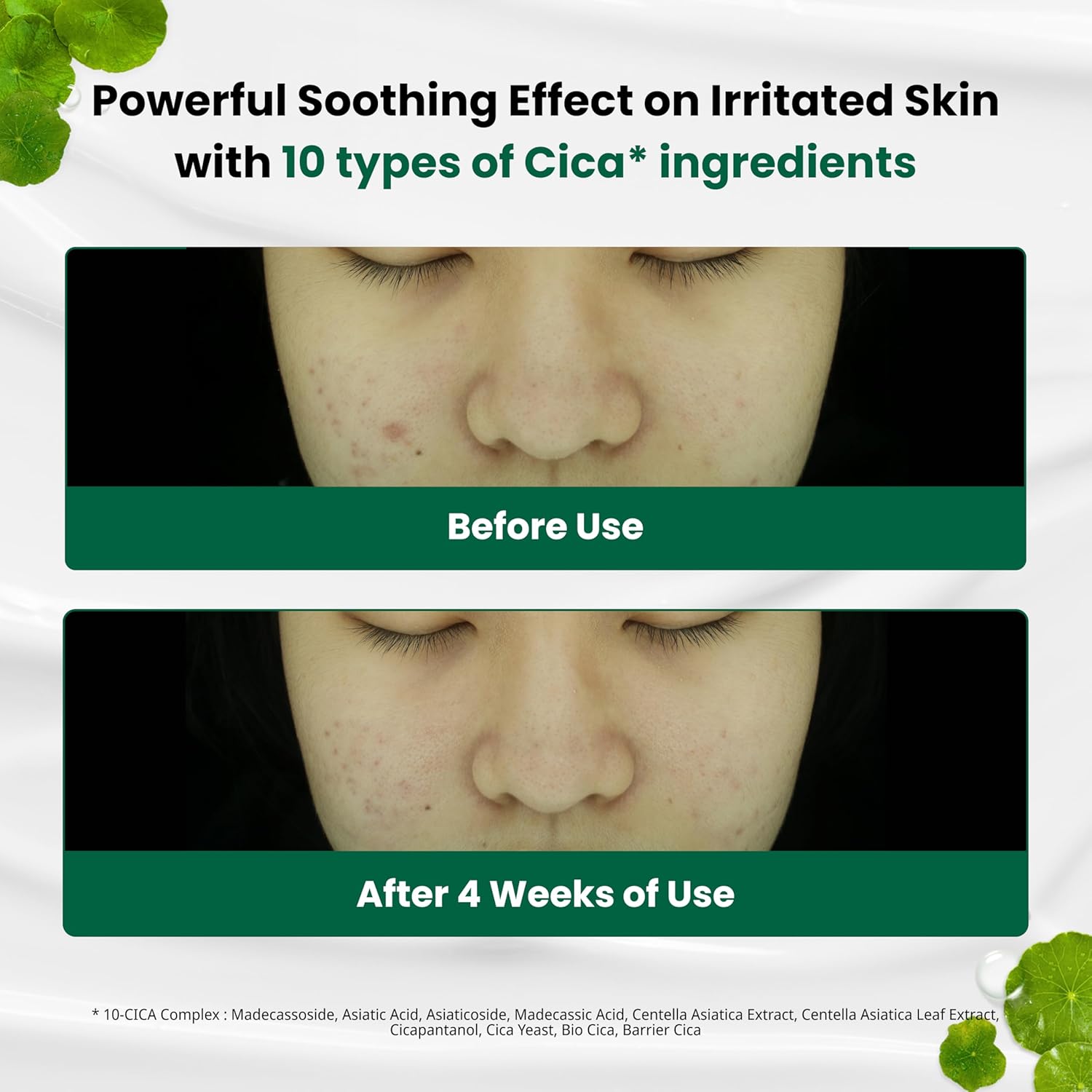 Dr.G Red Blemish Clear Soothing Korean Moisturizer Face Cream, 70ml - Cica Cream, Korean Skin Care Moisturizer, Korean Face Moisturizer, Facial Moisturizer, Korean Skincare, K Beauty Skincare