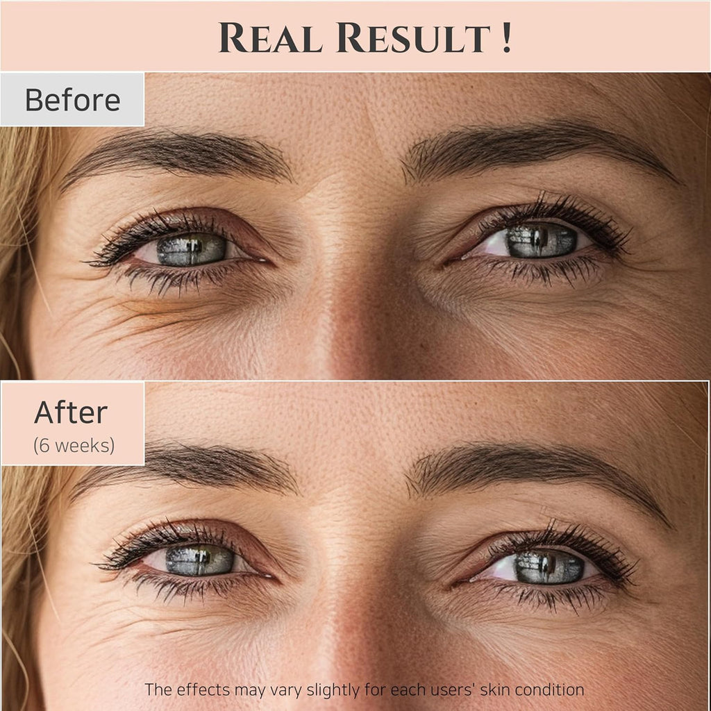 Beauty of Joseon Revive Eye Serum with Retinal Niacinamide Correction for Puffy Eye Bags Fine Lines Dark Circles Wrinkles, Korean Skin Care 30ml