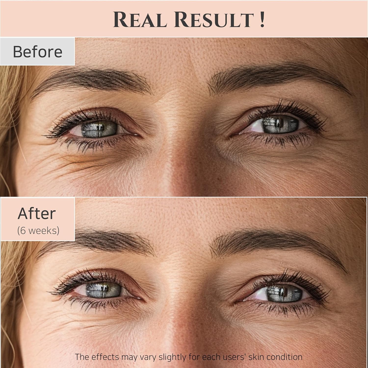 Beauty of Joseon Revive Eye Serum with Retinal Niacinamide Correction for Puffy Eye Bags Fine Lines Dark Circles Wrinkles, Korean Skin Care 30ml