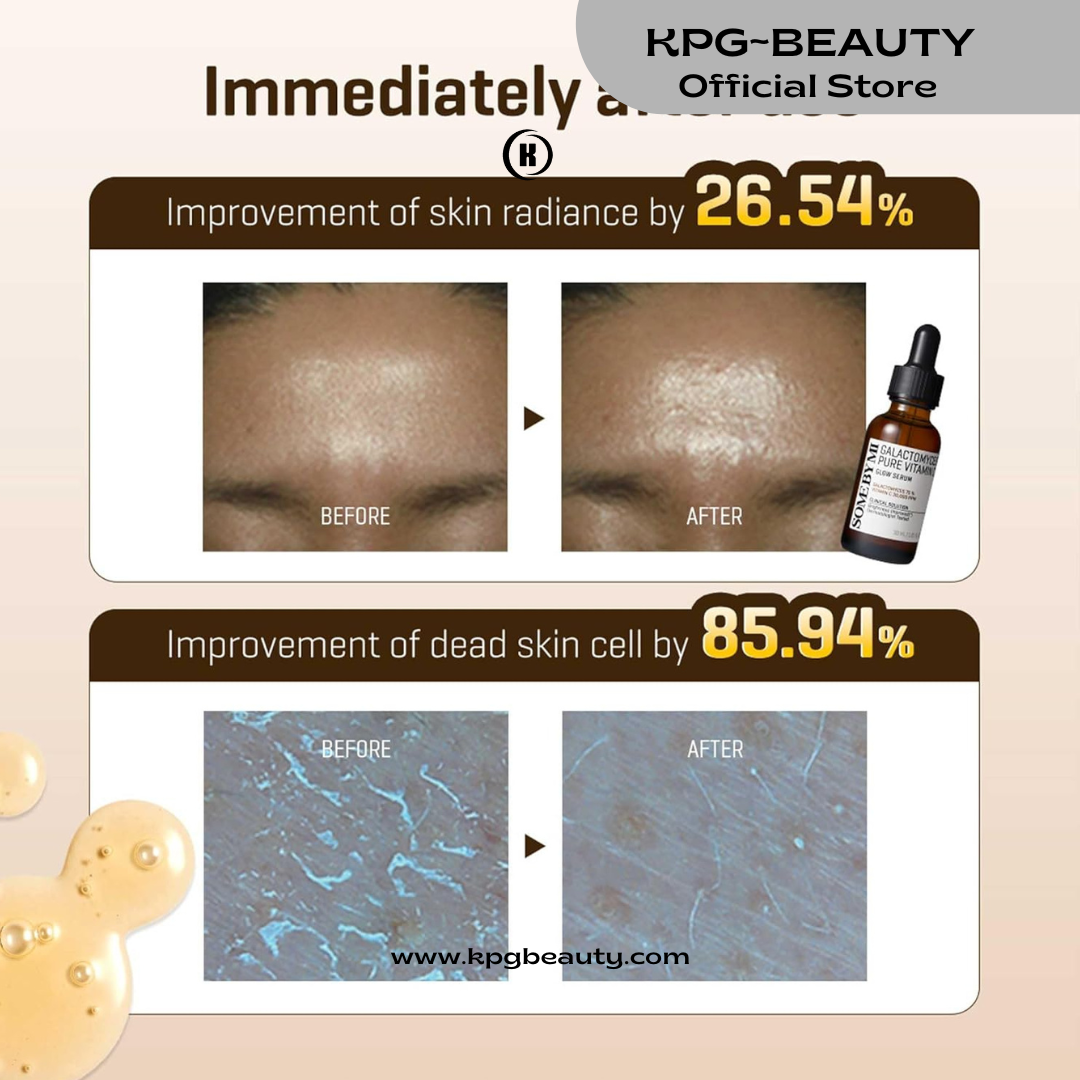 SOME BY MI Galactomyces Pure Vitamin C Glow Serum - 1.01Oz, 30ml - Korean Vitamin C Face Serum for Glow Glass Skin - Dark Spot Correcting Serum with Skin Texture and Elasticity Care - Korean Skin Care