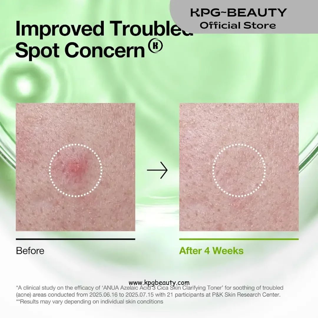 Anua Azelaic Acid Clarifying Toner 3 CICA Skin Clarifying Toner.