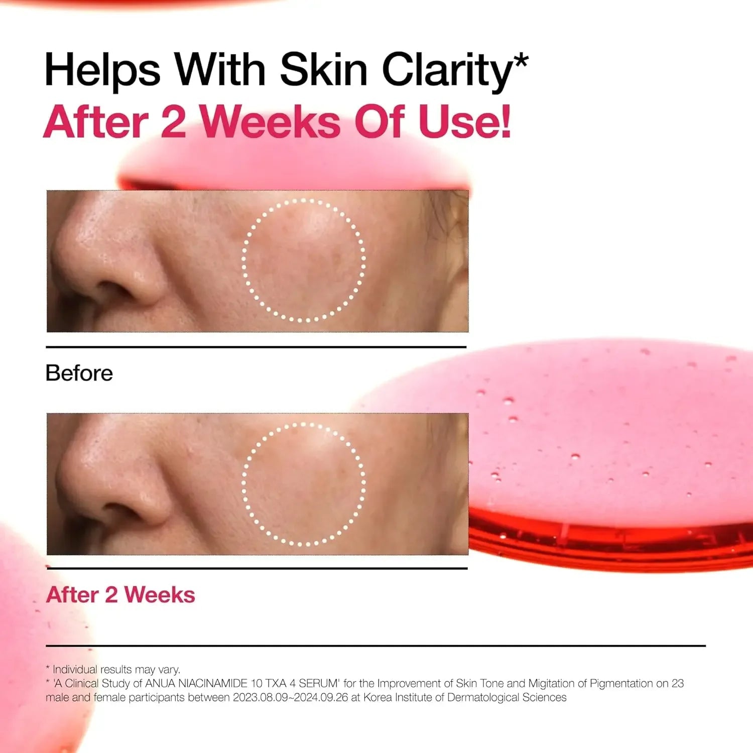 ANUA Niacinamide 10 + TXA 4 Serum, Hyaluronic Acid, Tranexamic acid KPGBEAUTY