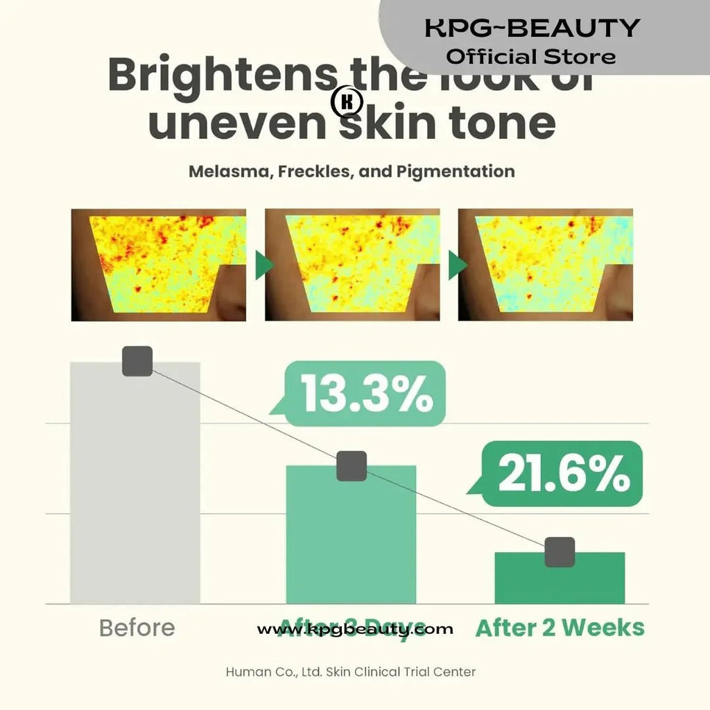 AXIS-Y Dark Spot Correcting Glow Serum - 5% Niacinamide Dark Spot Types 50 ml - KPGBEAUTY