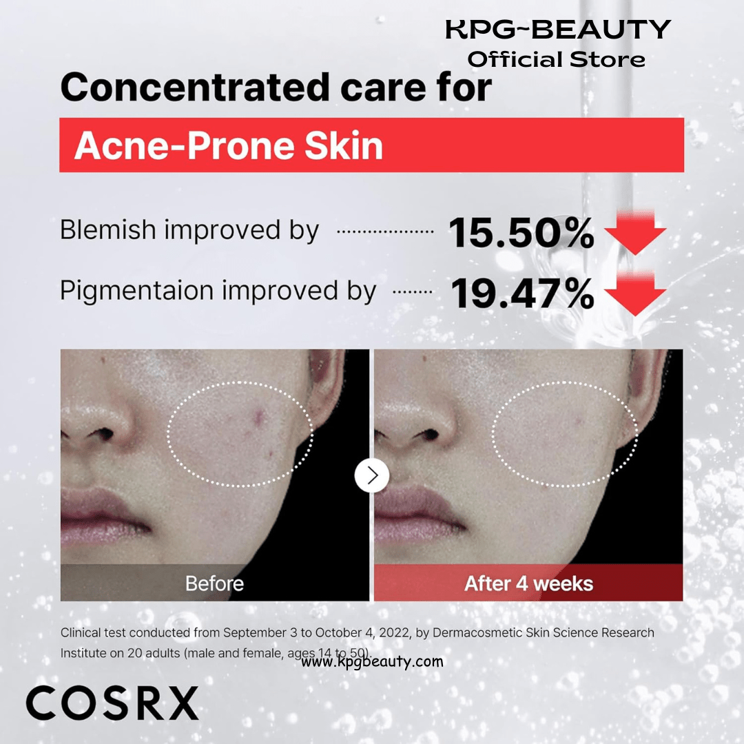 COSRX 15% Niacinamide Face Serum, 0.67 fl oz, Pore Minimizer Serum for Face, Even Skin Tone, Korean Skin CareCOSRX
