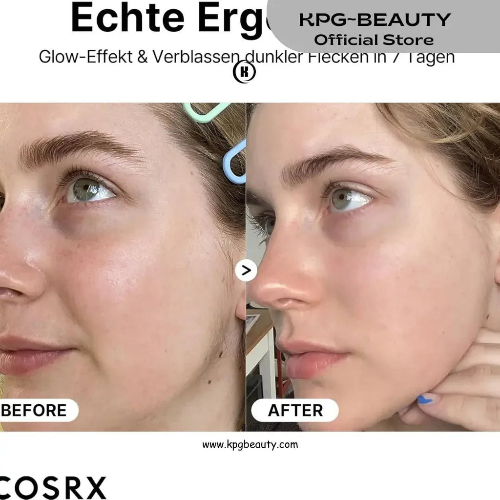 COSRX Pure Vitamin C 23% Serum – Brightening & Anti - Aging SolutionCOSRX