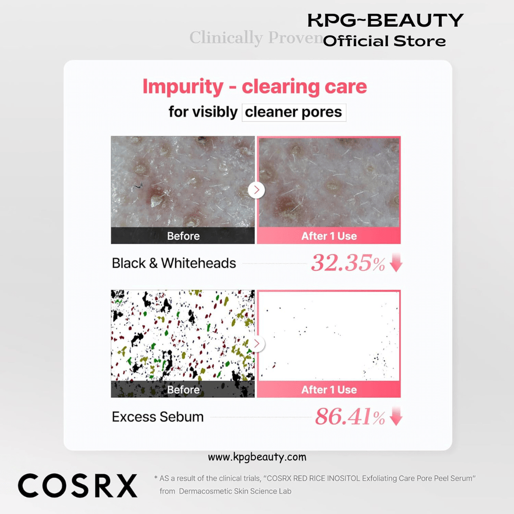 COSRX Red Rice Pore Wash - Off Peel Shot, 94% Reduction in Dead Skin Cells, Gentle Blackhead Remover & Face Exfoliator, Pore Minimizer for Face with Rice & Inositol, Mothers day gift, Korean Skin CareCOSRX