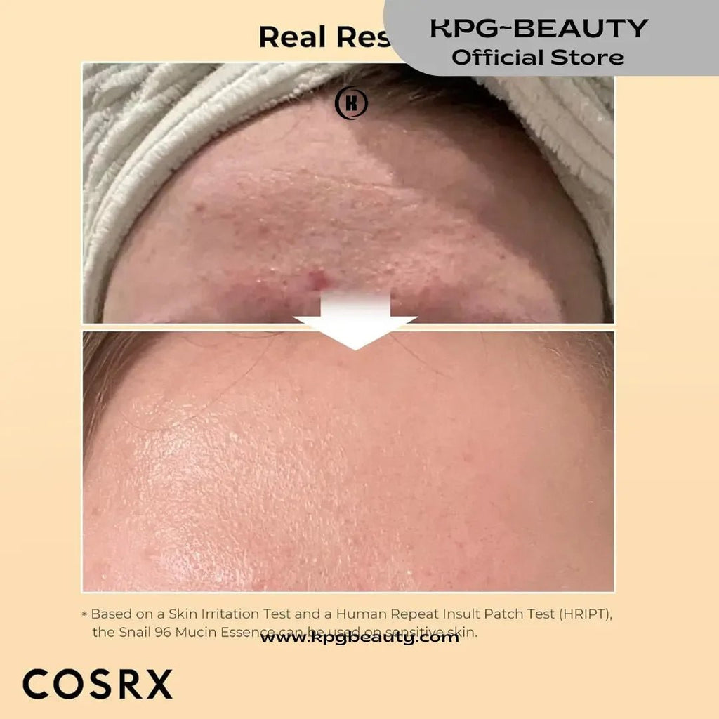 COSRX Snail Mucin Skincare Set – Deep Hydration & Skin RepairCOSRX