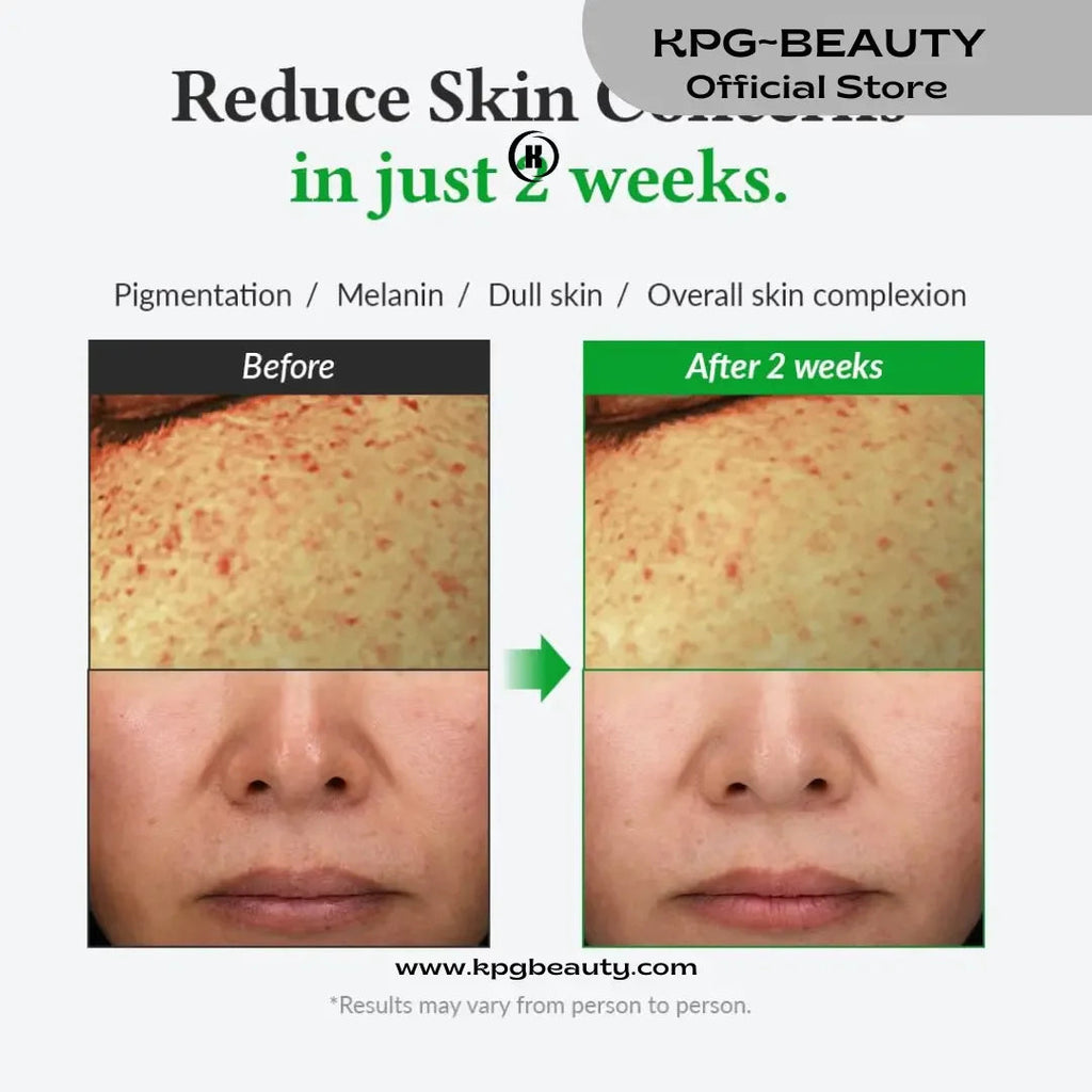 Dr.Althea Gentle Vitamin C Serum | Benefits Skin Tone and PigmentationDr Althea