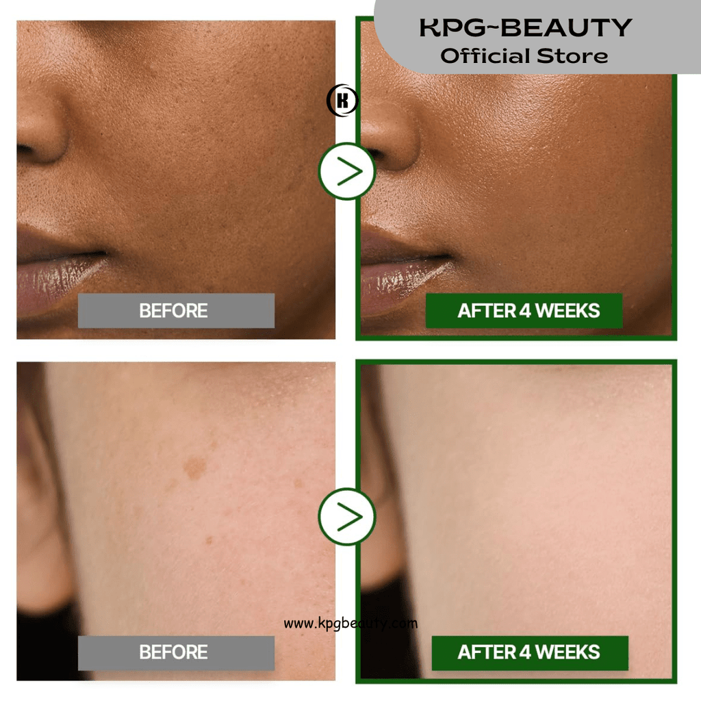 GOODAL Green Tangerine Vitamin C Cream 50ml – Brightening Cream with 5% Niacinamide | Korean Skincare | KPG BeautyGoodal