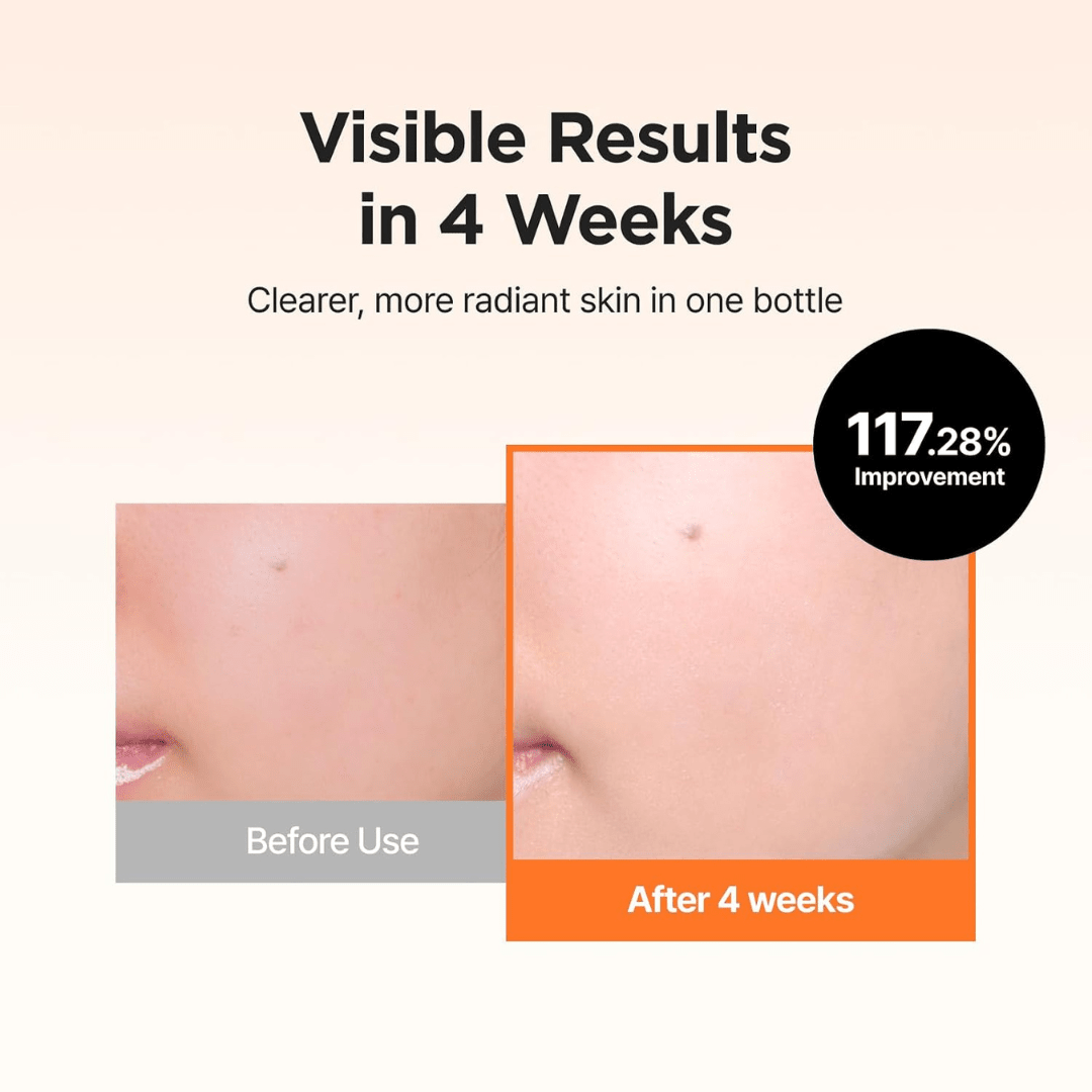 ISNTREE Hyper Vitamin C 23 Serum 20ml KPG BEAUTYISNTREE