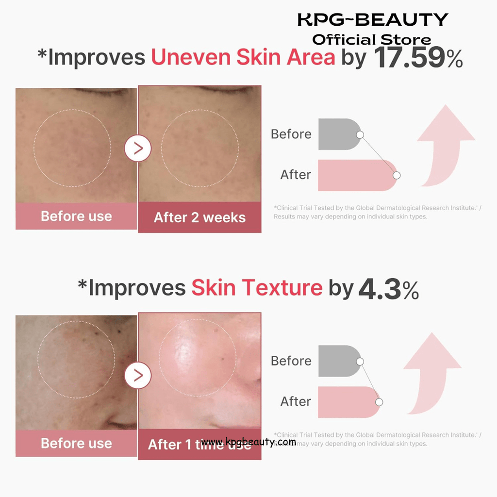 medicube Exosome Shot PDRN Pink Collagen 2,000 PPM Spicule Facial Serum | Liquid Skin Booster | Exosome, Salmon DNA Spicules | Uneven Skin Tone, Pore Care, Skin Texture | Korean Skincare, 1.01 fl.ozMedicube