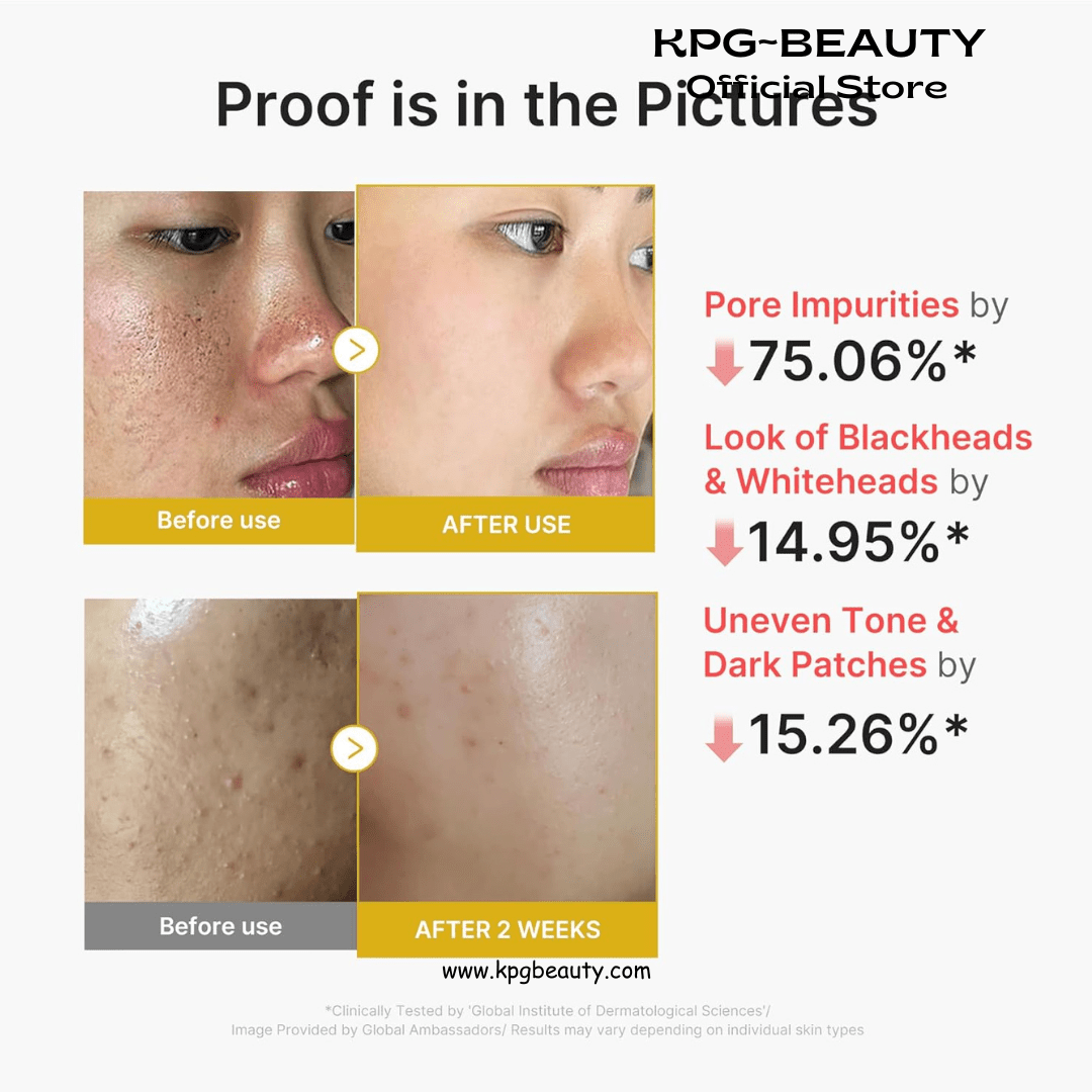 medicube Peel Shot with Kojic Acid Turmeric | Reset in One Step | Gentle Exfoliating Serum with BHA, LHA, PHA for Dead Skin Cells, Blackheads, Excess Sebum | For Dull, Rough, Troubled Skin | 2.7 fl.ozMedicube