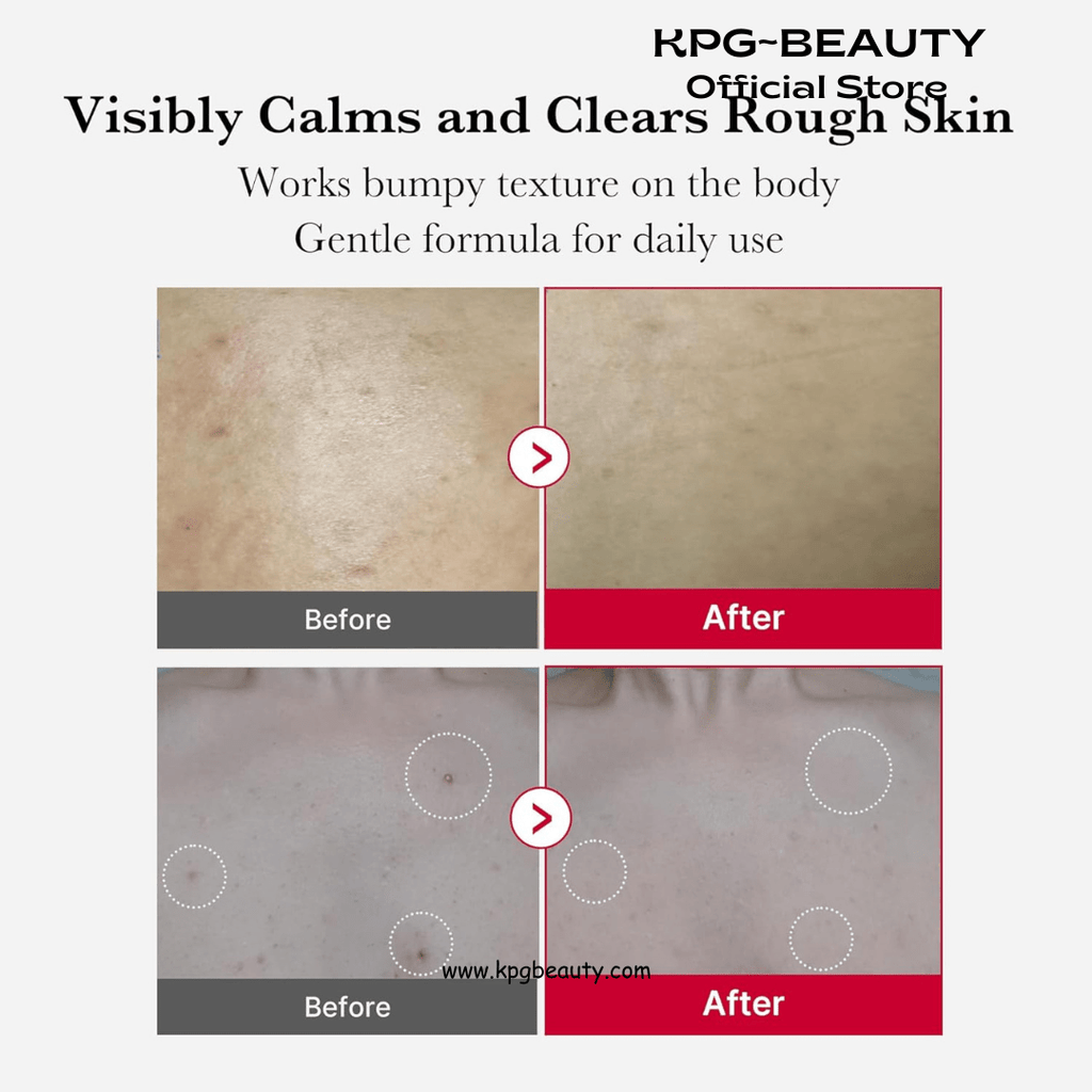 medicube Red Body Peeling Shot, AHA + BHA Exfoliating Body Spray for Summer - Ready Smooth Skin, Treats Strawberry Skin, Bumps & Breakouts, 3.88 ozMedicube