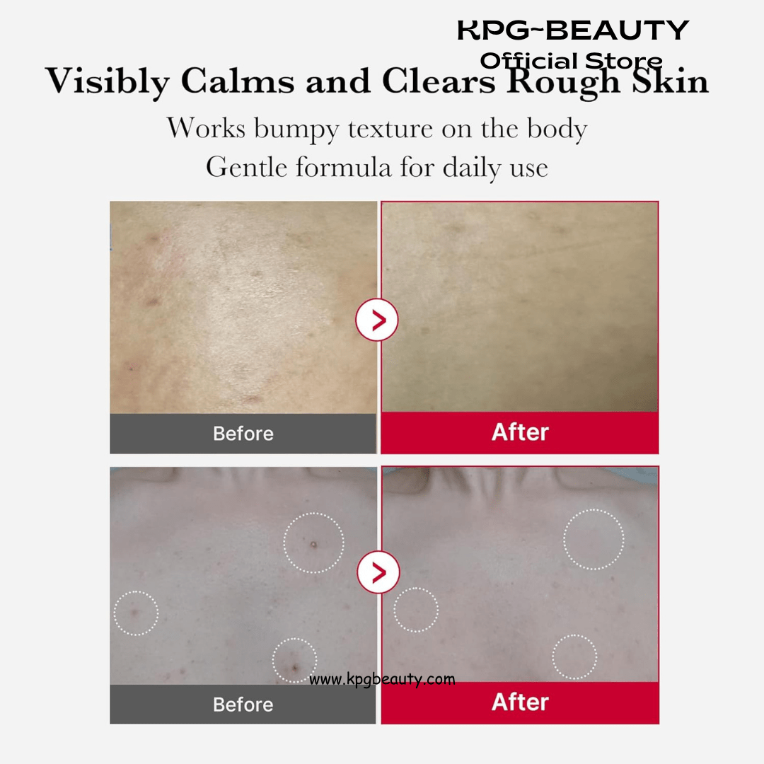 medicube Red Body Peeling Shot, AHA + BHA Exfoliating Body Spray for Summer - Ready Smooth Skin, Treats Strawberry Skin, Bumps & Breakouts, 3.88 ozMedicube