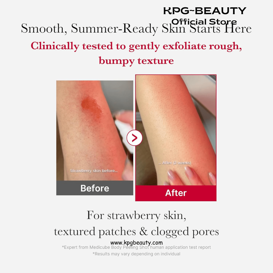 medicube Red Body Peeling Shot, AHA + BHA Exfoliating Body Spray for Summer - Ready Smooth Skin, Treats Strawberry Skin, Bumps & Breakouts, 3.88 ozMedicube