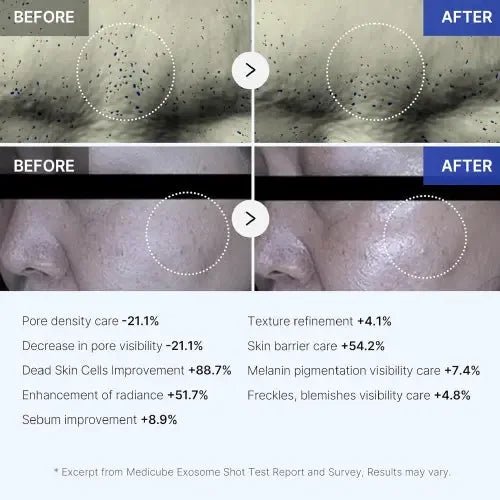 MEDICUBE Zero One - Day Exosome Shot Pore AmpouleMedicube