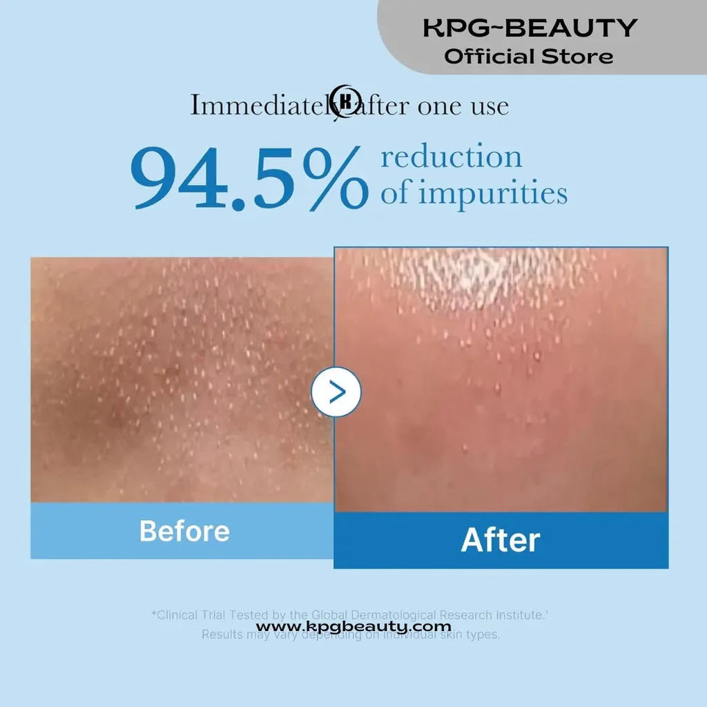 medicube Zero Pore Blackhead Deep Cleansing Oil | Makeup Remover for all