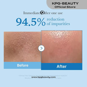 medicube Zero Pore Blackhead Deep Cleansing Oil | Makeup Remover for all