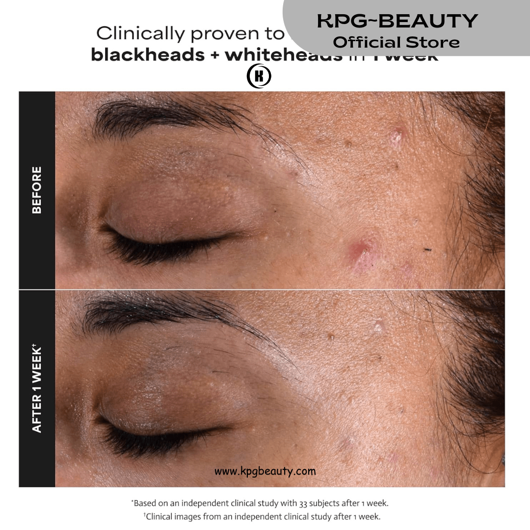 Paula's Choice Skin Perfecting 2% BHA Liquid Exfoliant with Salicylic Acid – Pore Minimizer & Blackhead Treatment 30 ml | KPG BeautyKPGBEAUTY