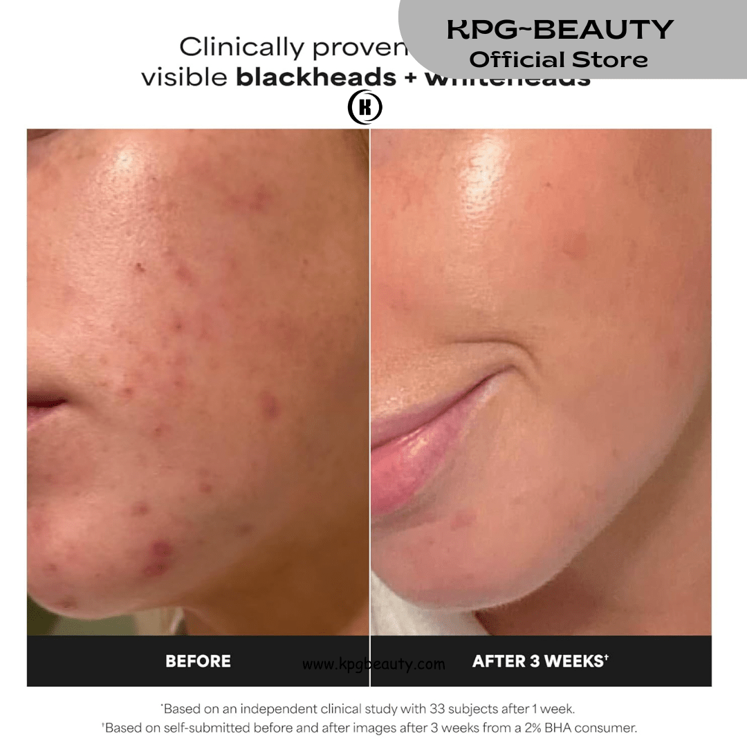 Paula's Choice Skin Perfecting 2% BHA Liquid Exfoliant with Salicylic Acid – Pore Minimizer & Blackhead Treatment 30 ml | KPG BeautyKPGBEAUTY