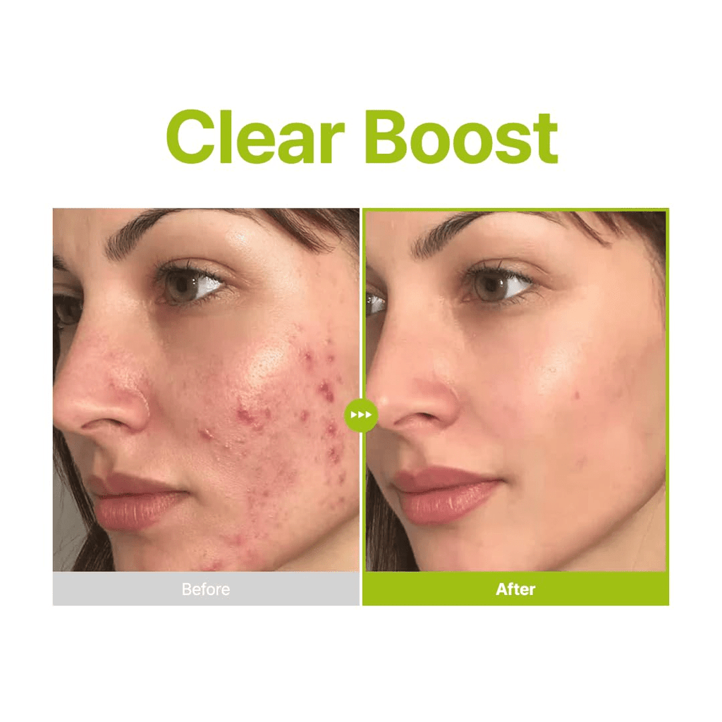 PURITO Azelaic Acid 10% + Kojic Acid + Tea Tree Facial Serum Blemish Care KPG BEAUTYPurito Seoul