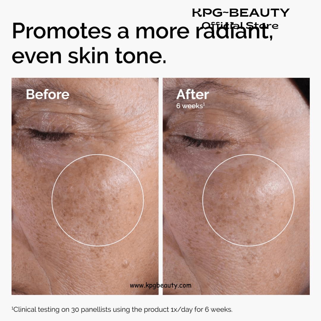 The Ordinary Glycolic Acid 7% Exfoliating Toner, Brightening and Smoothing Daily Toner for More Even - Looking Skin Tone, 100mlThe Ordinary