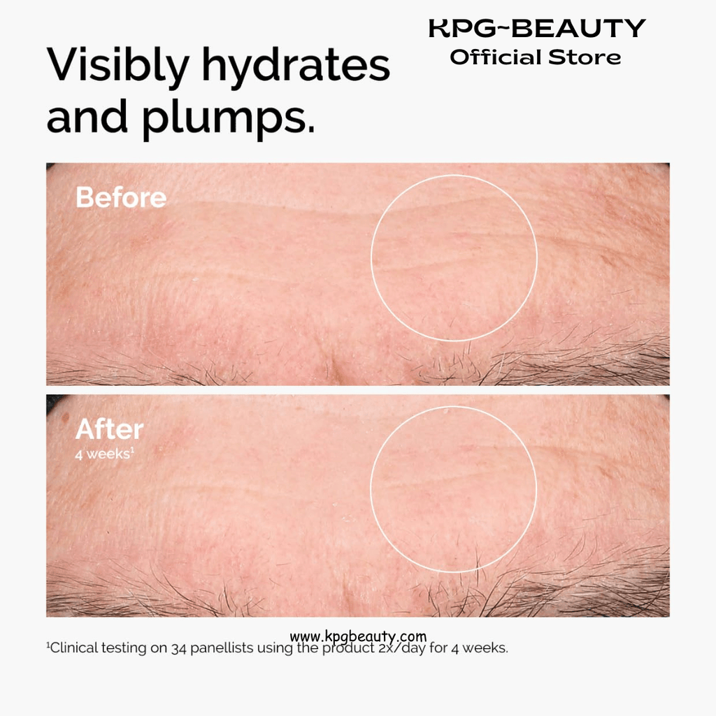 The Ordinary Hyaluronic Acid 2% + B5 (with Ceramides), Multi - Depth Hydration Serum for Plumper, Smoother SkinThe Ordinary