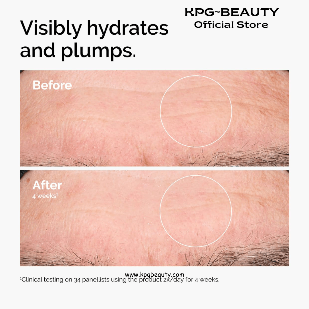 The Ordinary Hyaluronic Acid 2% + B5 (with Ceramides), Multi - Depth Hydration Serum for Plumper, Smoother SkinThe Ordinary